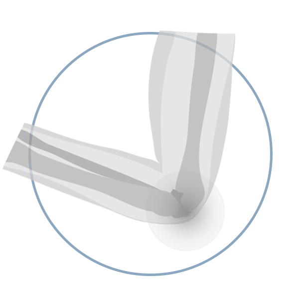 Sameer Singh Elbow Conditions