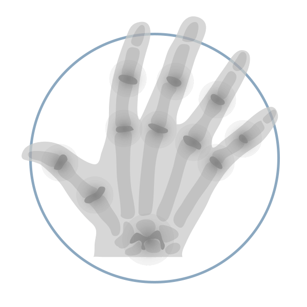 Sameer Singh Elbow Conditions