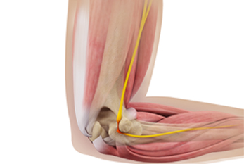 Sameer Singh Elbow Conditions
